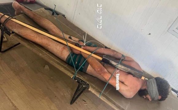 Imagen de preso palestino vuelve a denunciar torturas