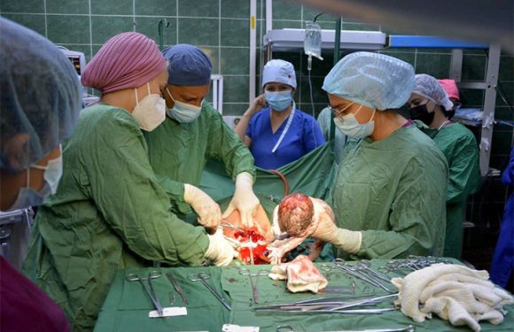 Primer parto de trillizos del año en Holguín: nacen tres varones en el Hospital Lenin