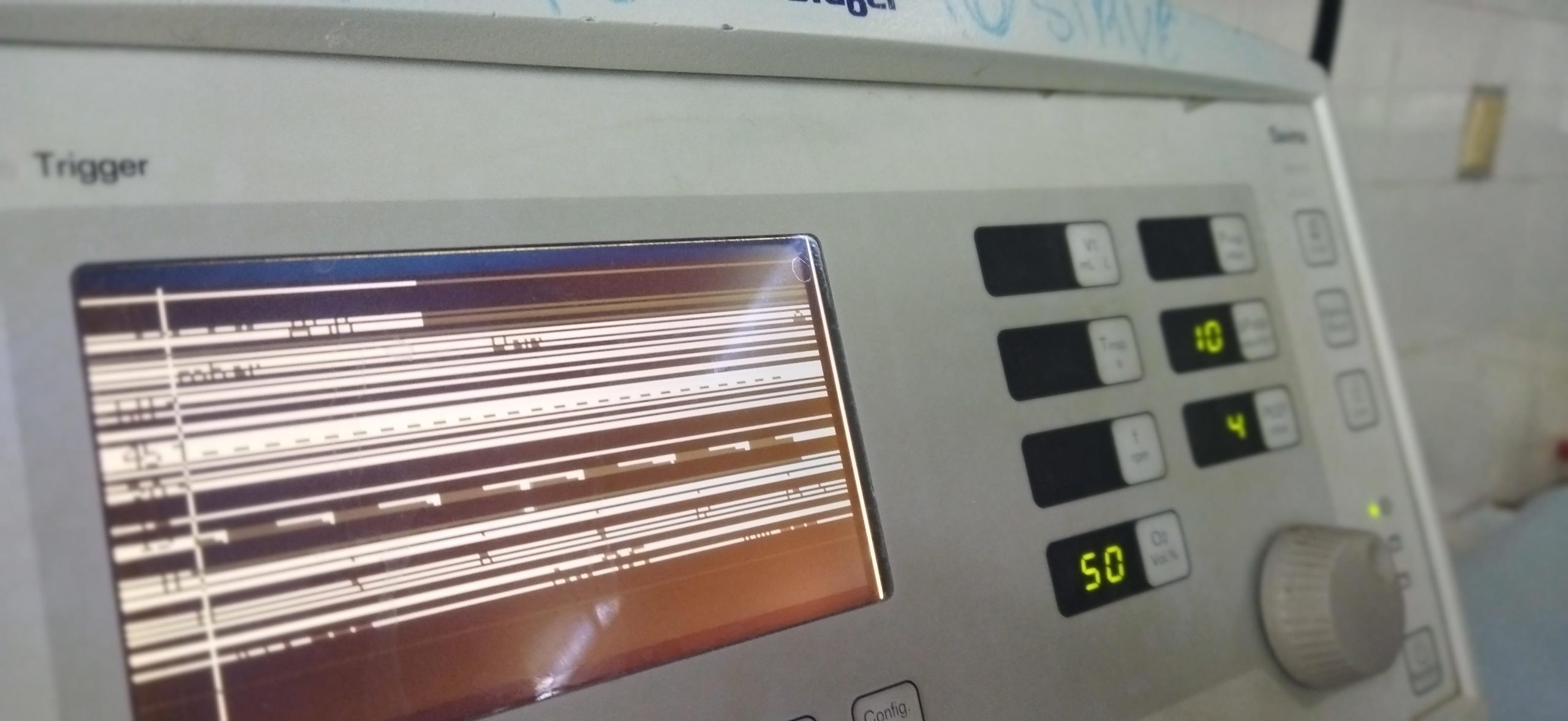 Terapias intensivas en Sancti Spíritus